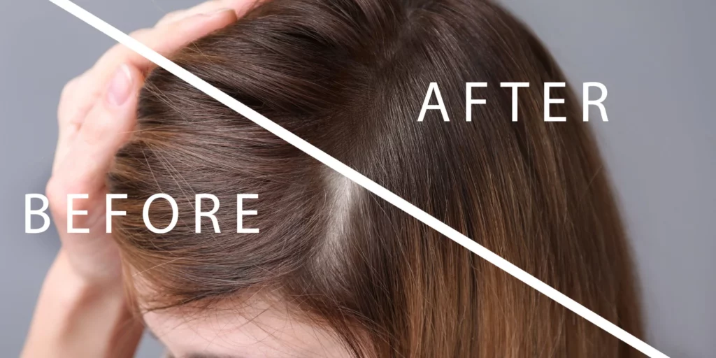 Features-of-the-Keravive-Hair-Regrowth-System-Burleso-Tx