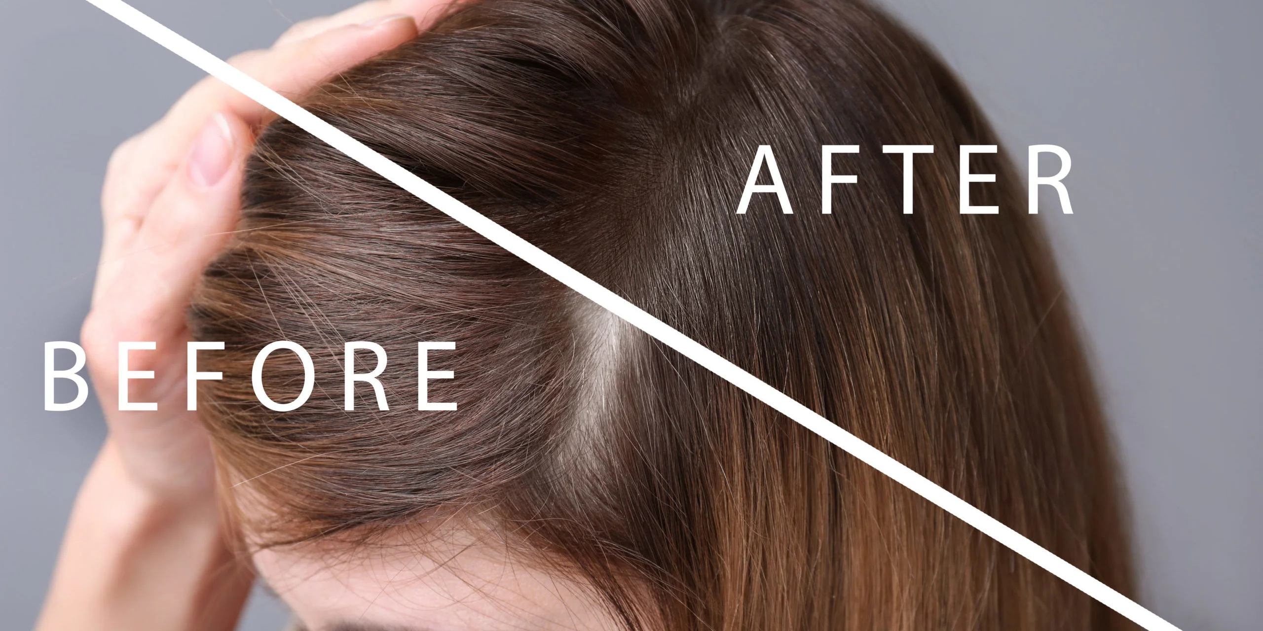 Features-of-the-Keravive-Hair-Regrowth-System-Burleso-Tx