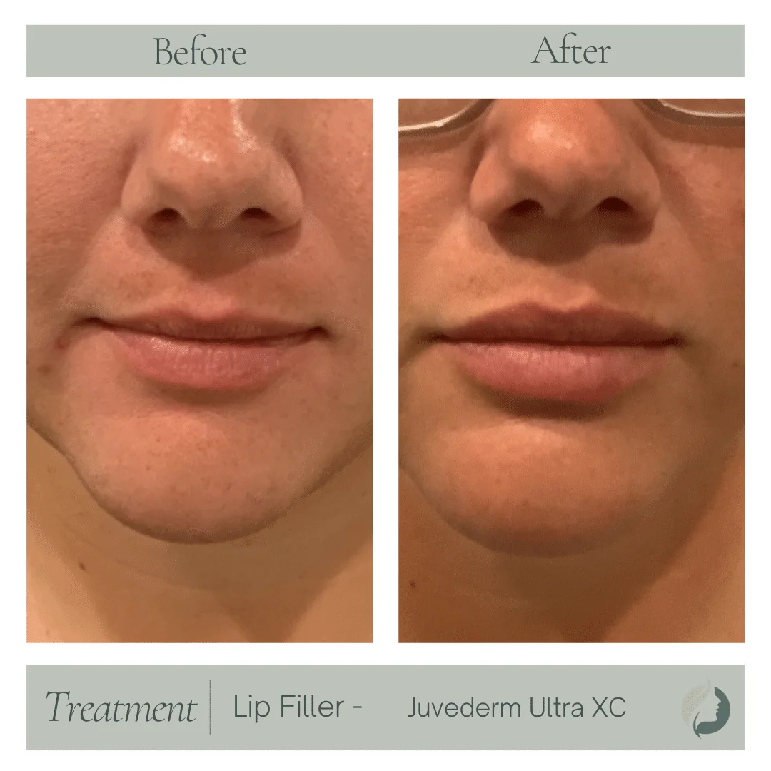 Premier Aesthetic Treatments in Burleson