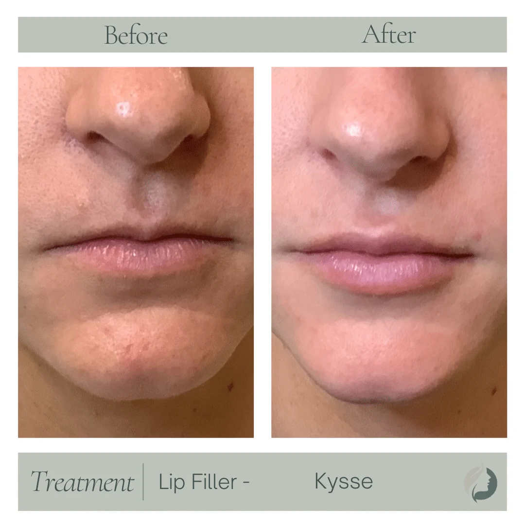 Premier Aesthetic Treatments in Burleson