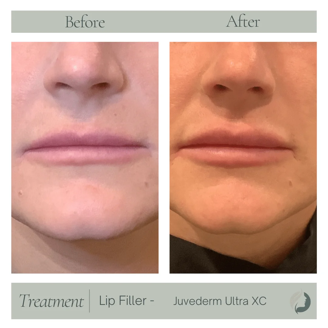 Premier Aesthetic Treatments in Burleson