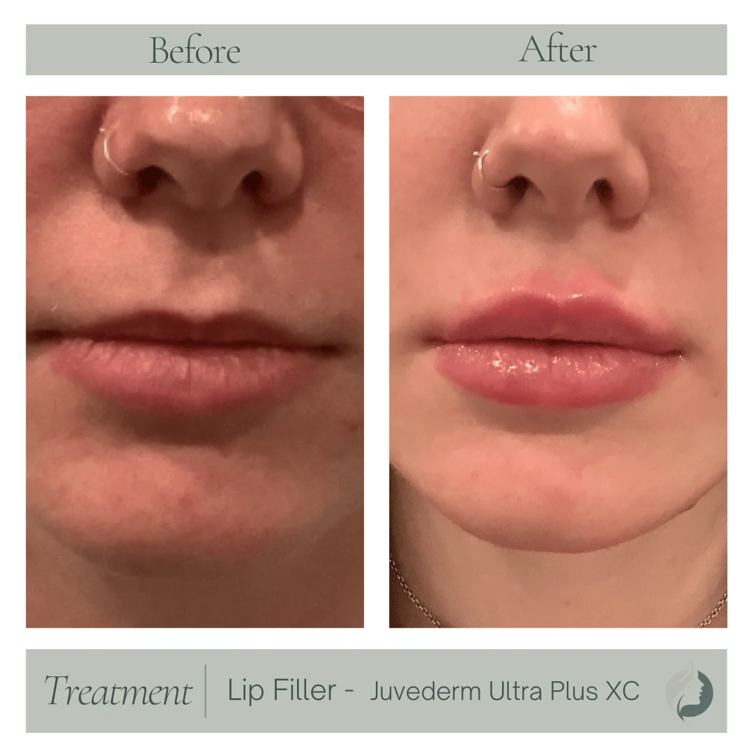 Premier Aesthetic Treatments in Burleson