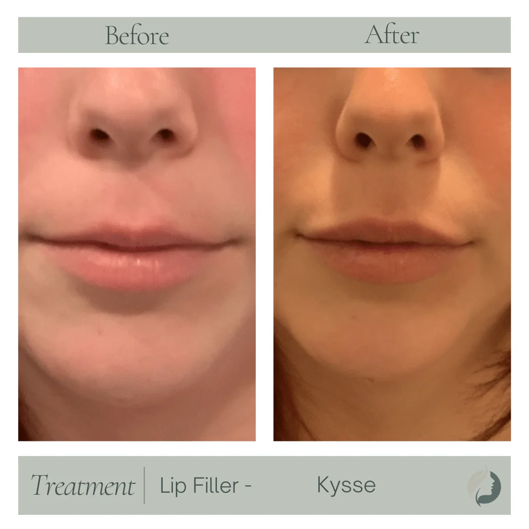 Premier Aesthetic Treatments in Burleson