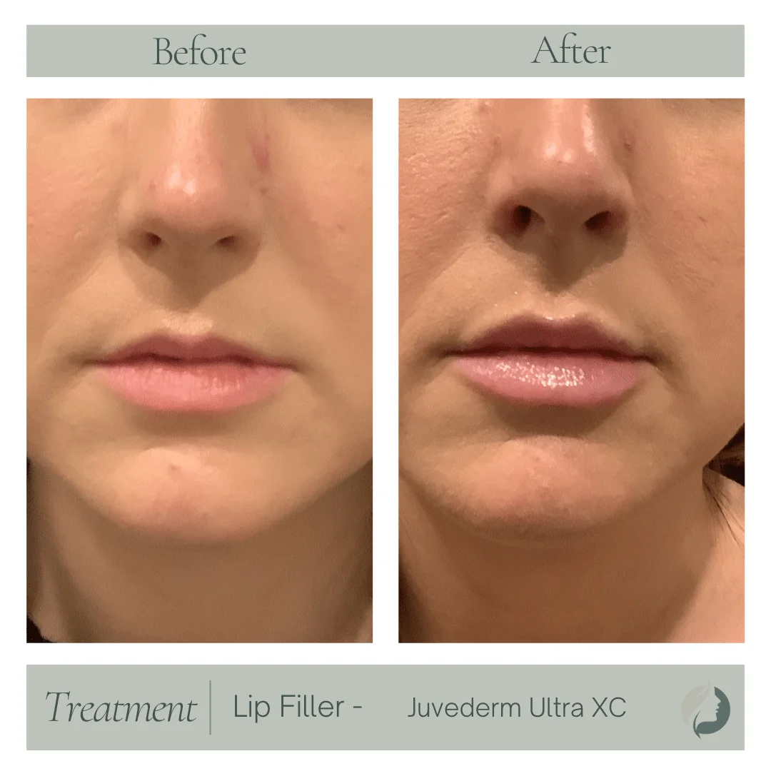 Premier Aesthetic Treatments in Burleson
