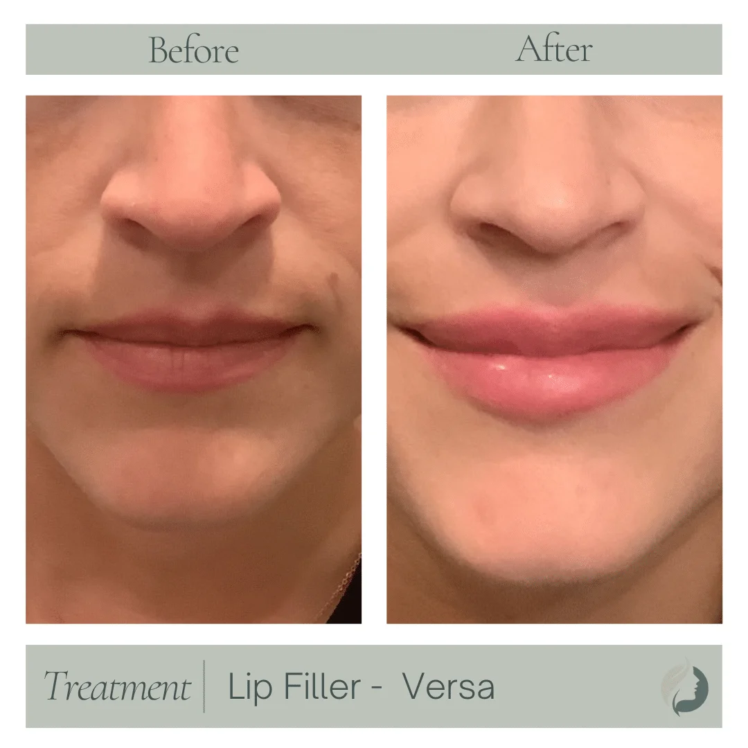 Premier Aesthetic Treatments in Burleson