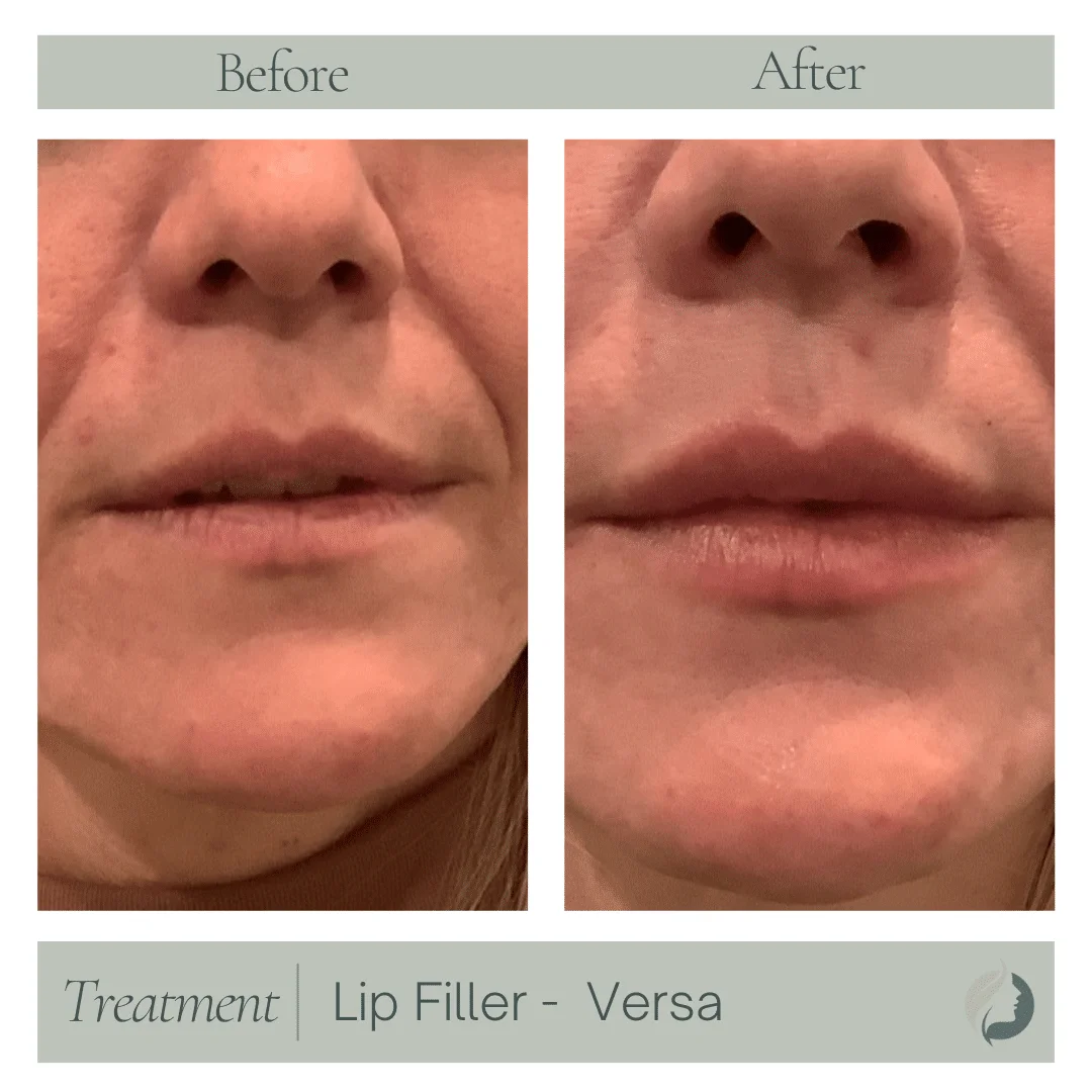 Premier Aesthetic Treatments in Burleson