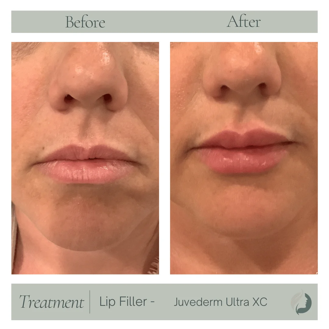 Premier Aesthetic Treatments in Burleson