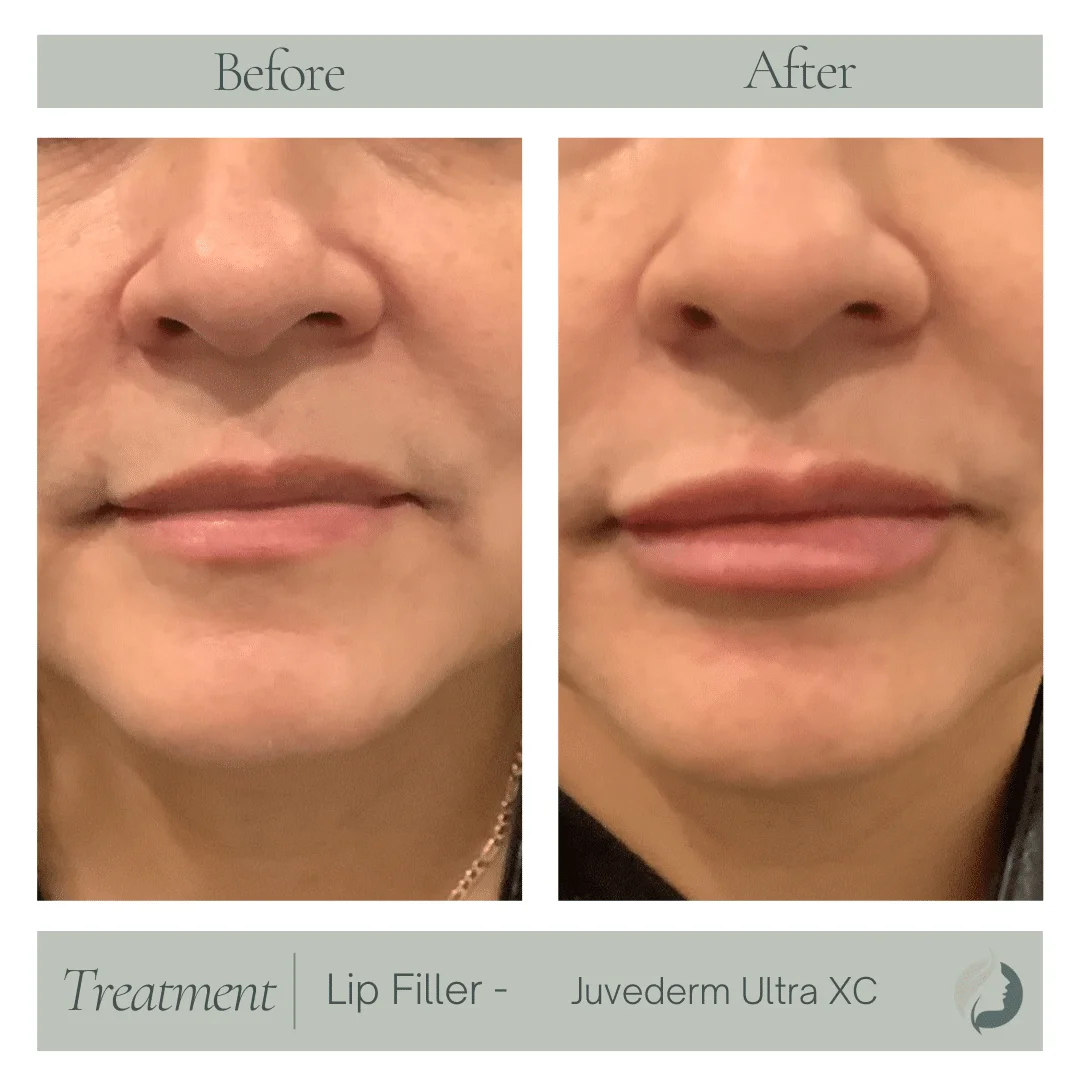 Premier Aesthetic Treatments in Burleson