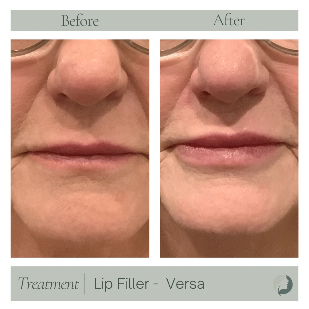 Premier Aesthetic Treatments in Burleson