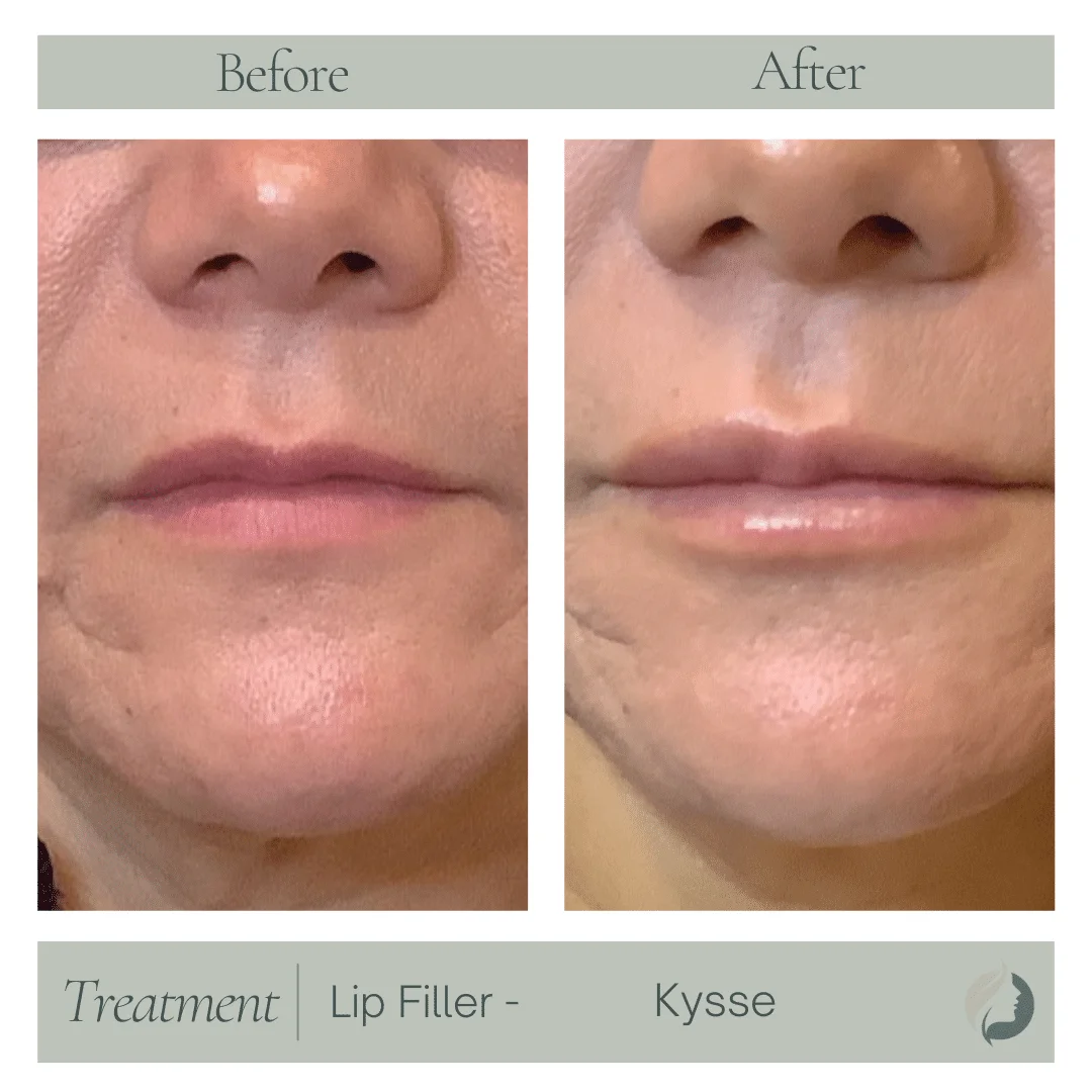 Premier Aesthetic Treatments in Burleson