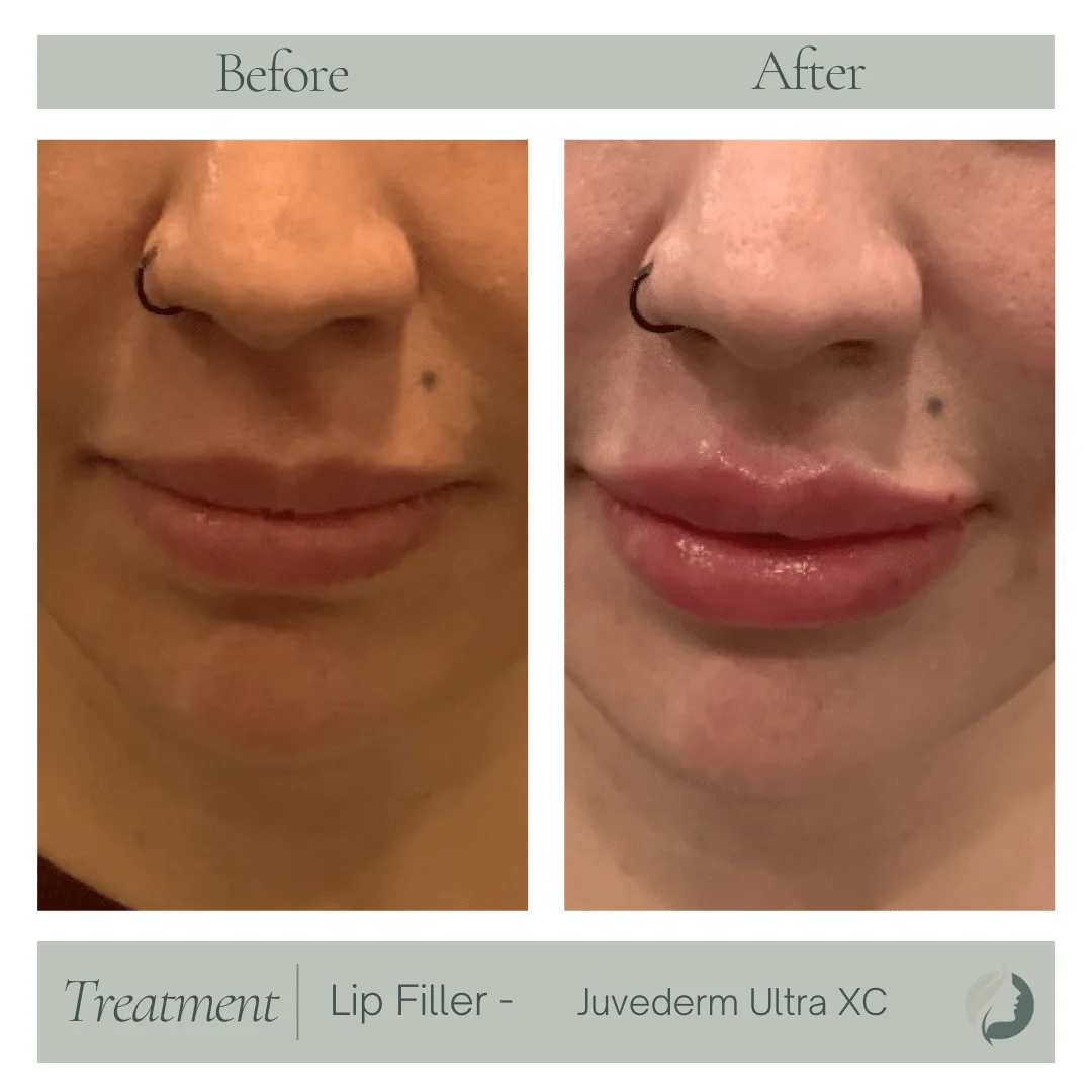 Premier Aesthetic Treatments in Burleson