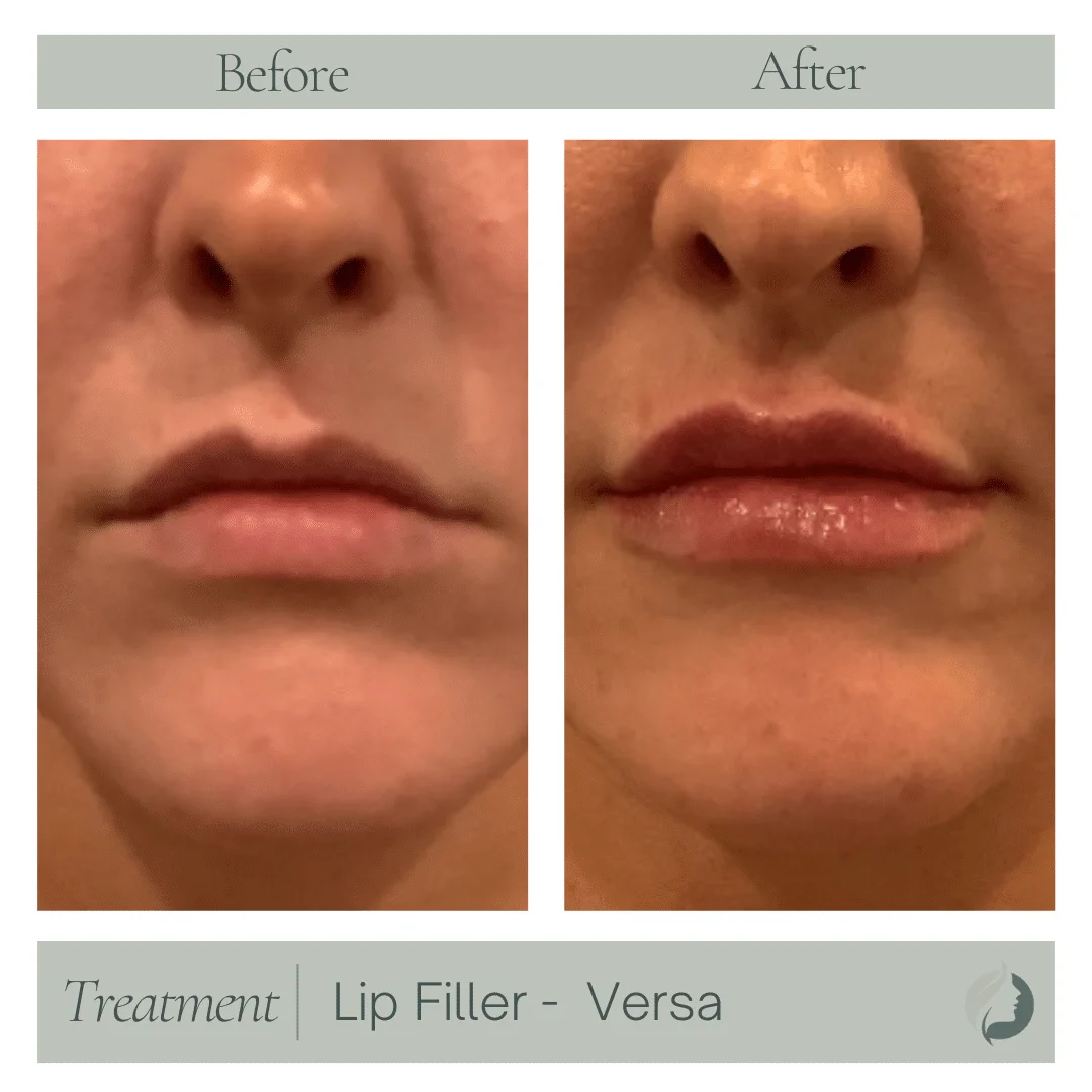 Premier Aesthetic Treatments in Burleson