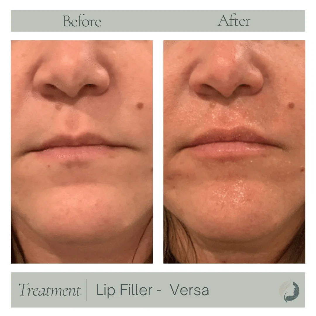 Premier Aesthetic Treatments in Burleson