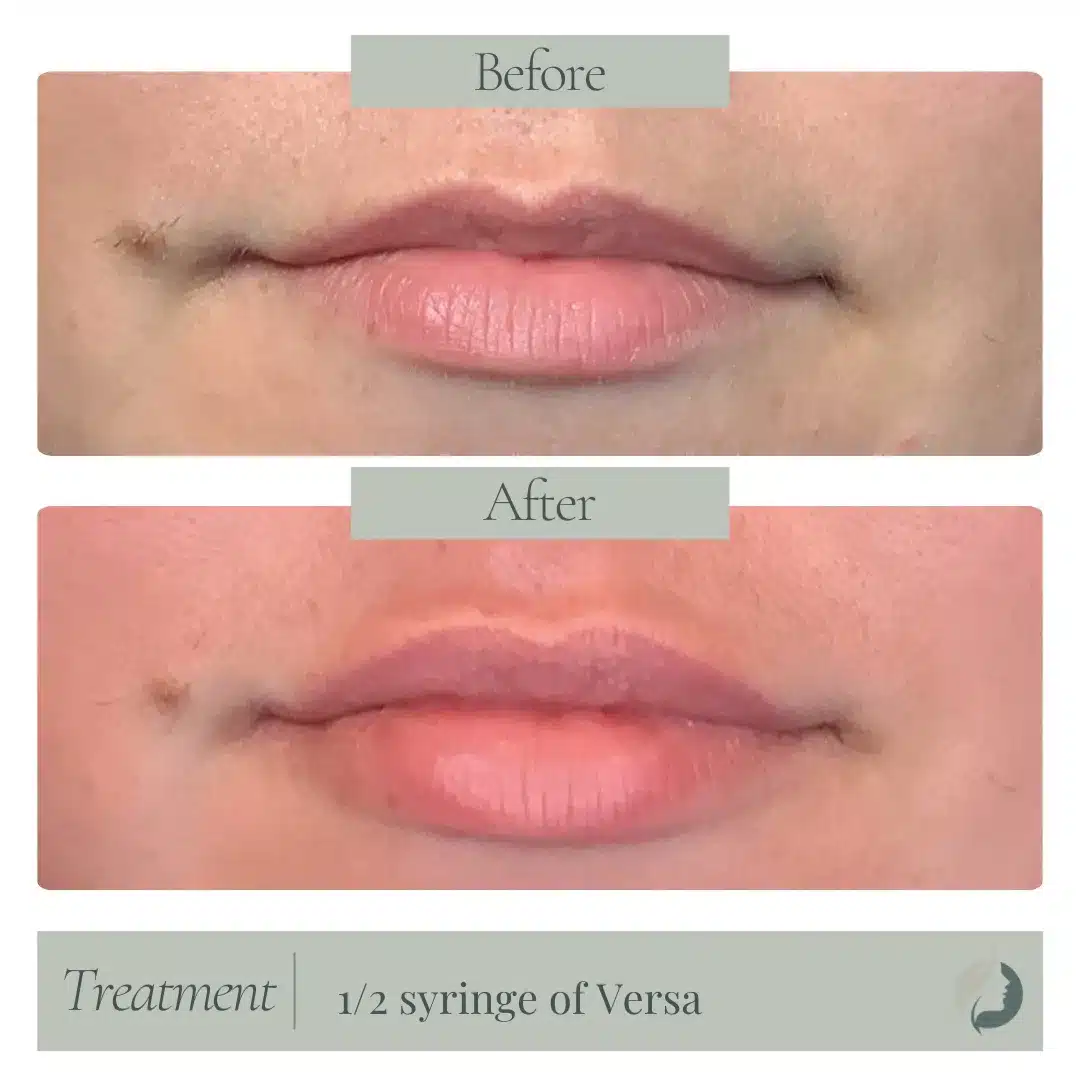 Premier Aesthetic Treatments in Burleson