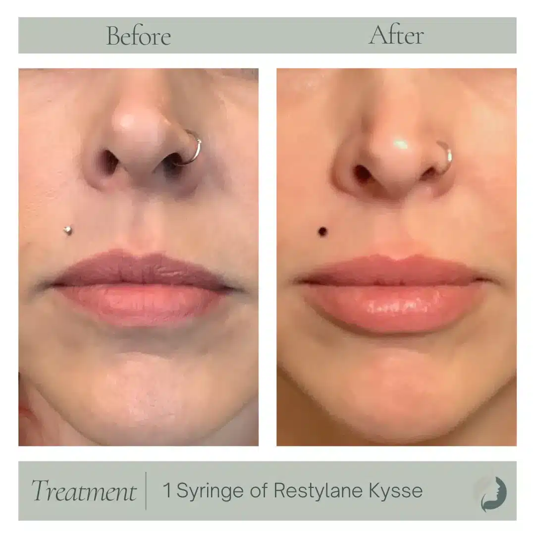 Premier Aesthetic Treatments in Burleson