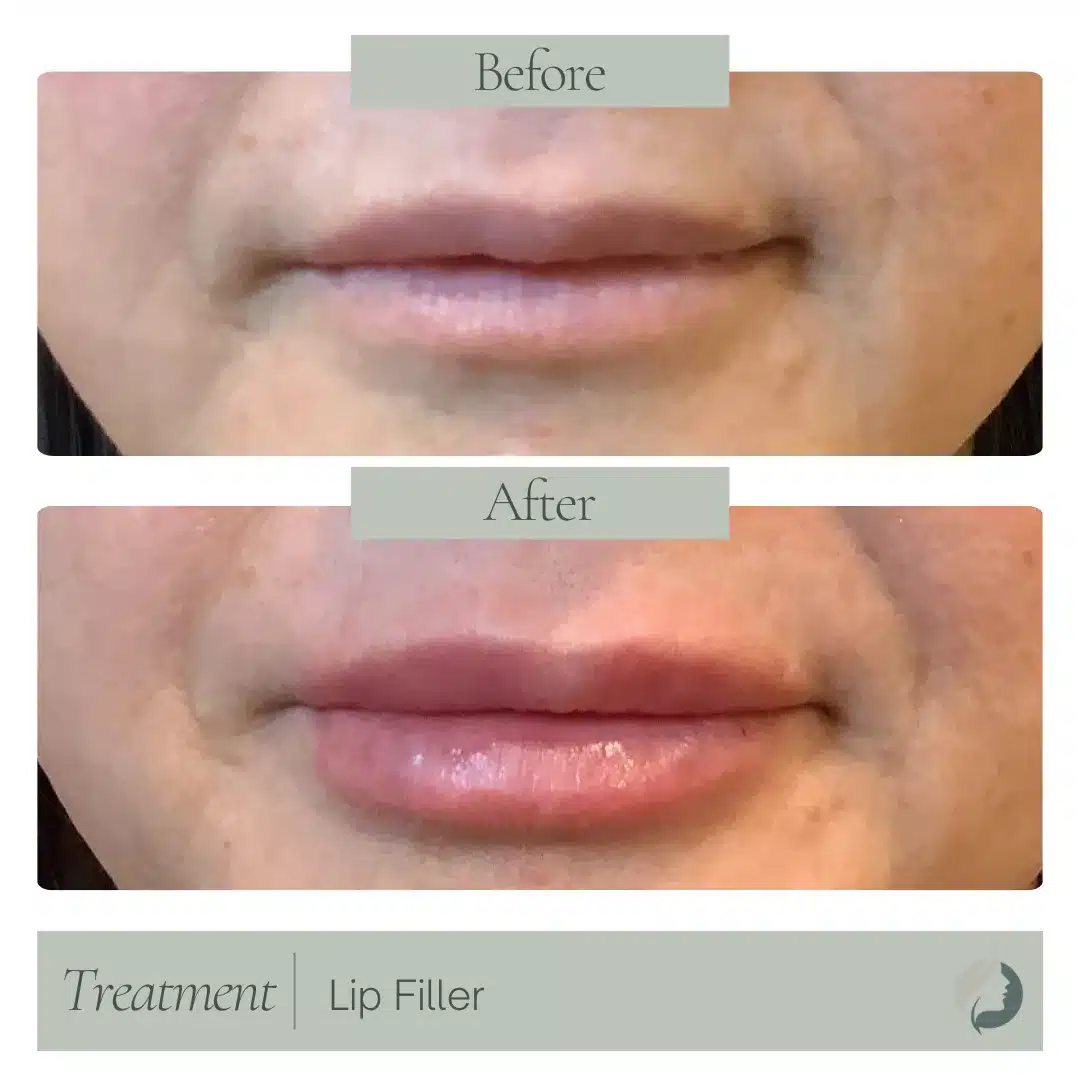 Premier Aesthetic Treatments in Burleson