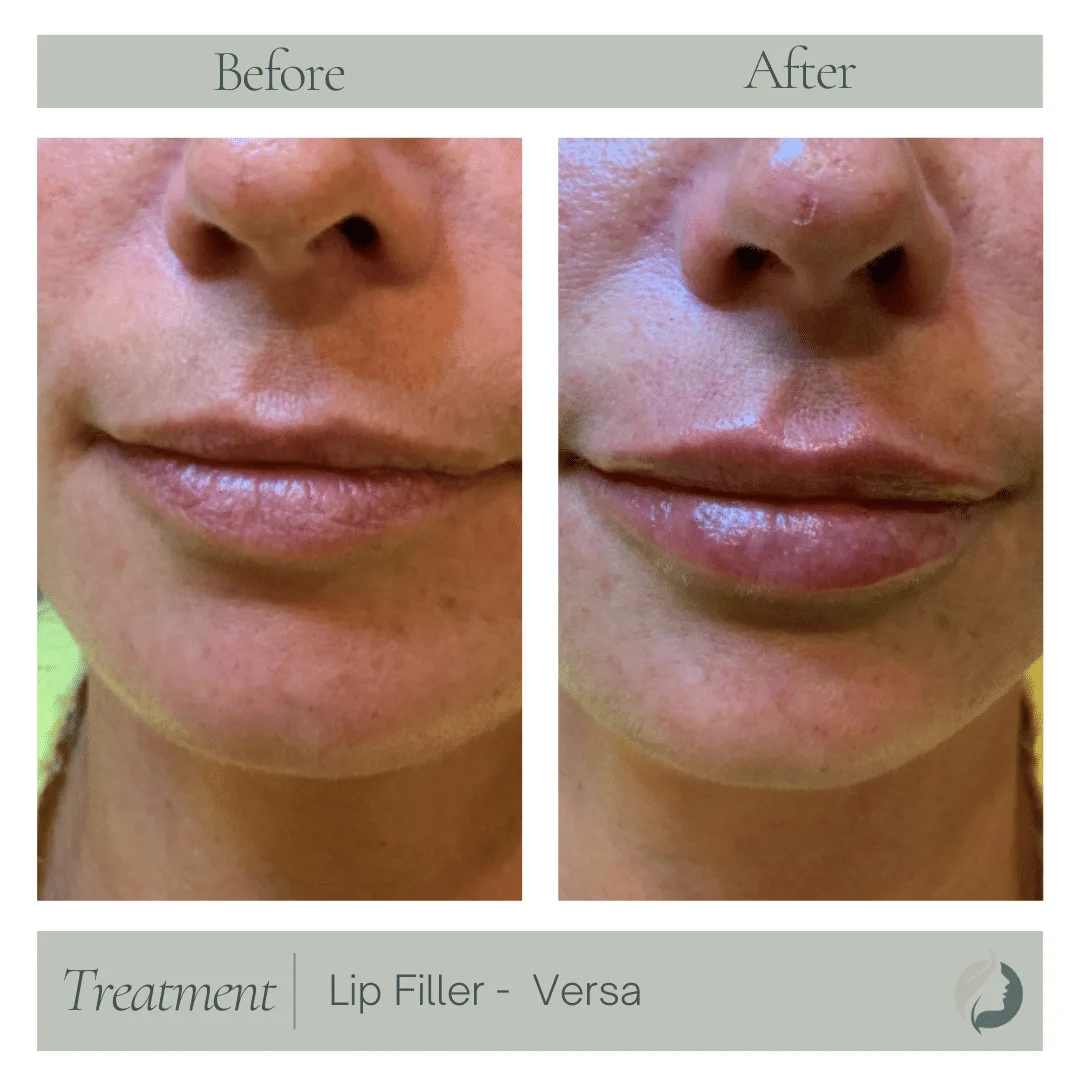 Premier Aesthetic Treatments in Burleson