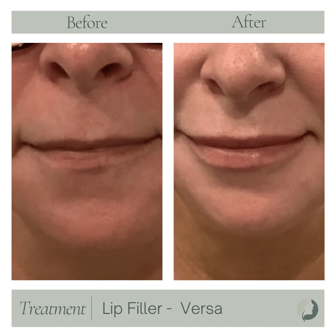 Premier Aesthetic Treatments in Burleson