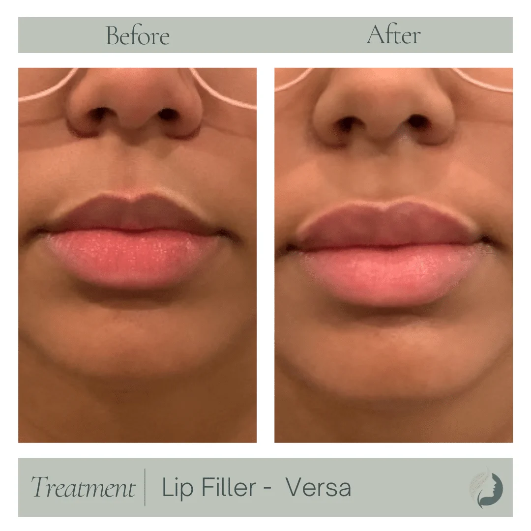 Premier Aesthetic Treatments in Burleson