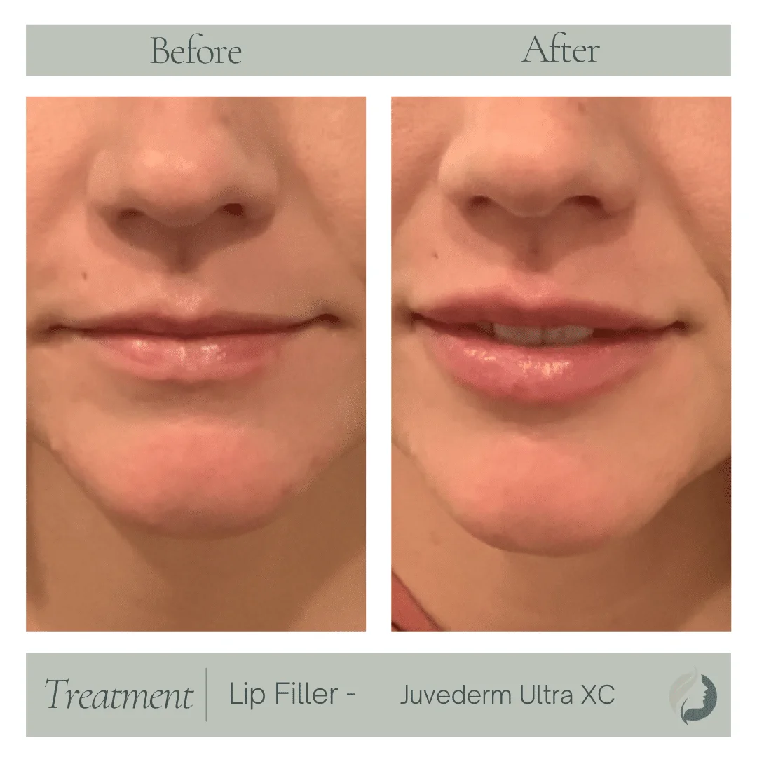 Premier Aesthetic Treatments in Burleson