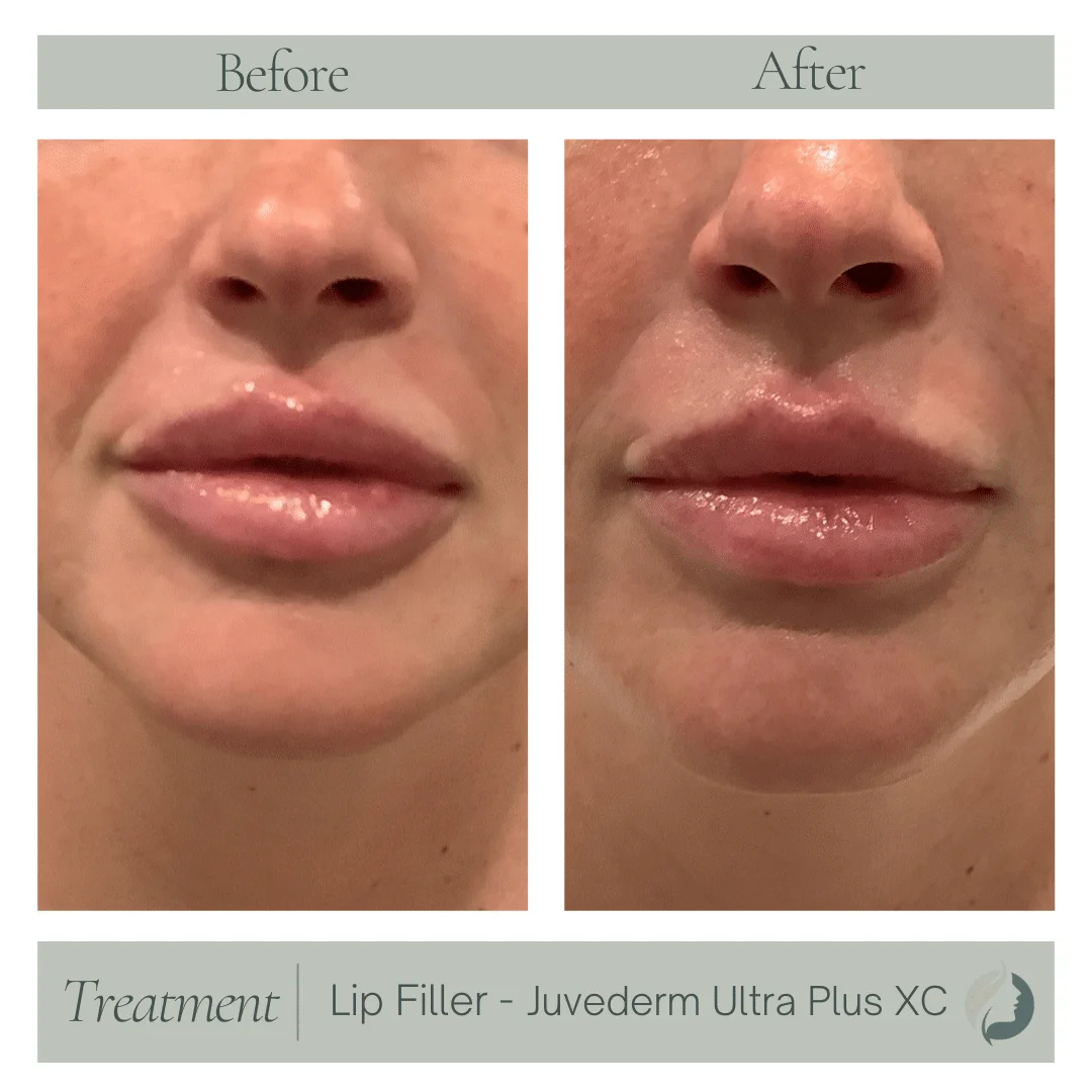 Premier Aesthetic Treatments in Burleson