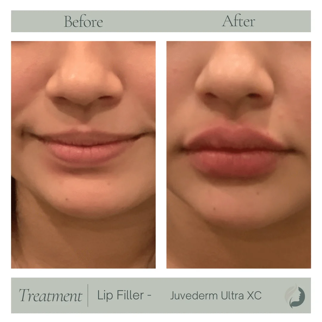 Premier Aesthetic Treatments in Burleson