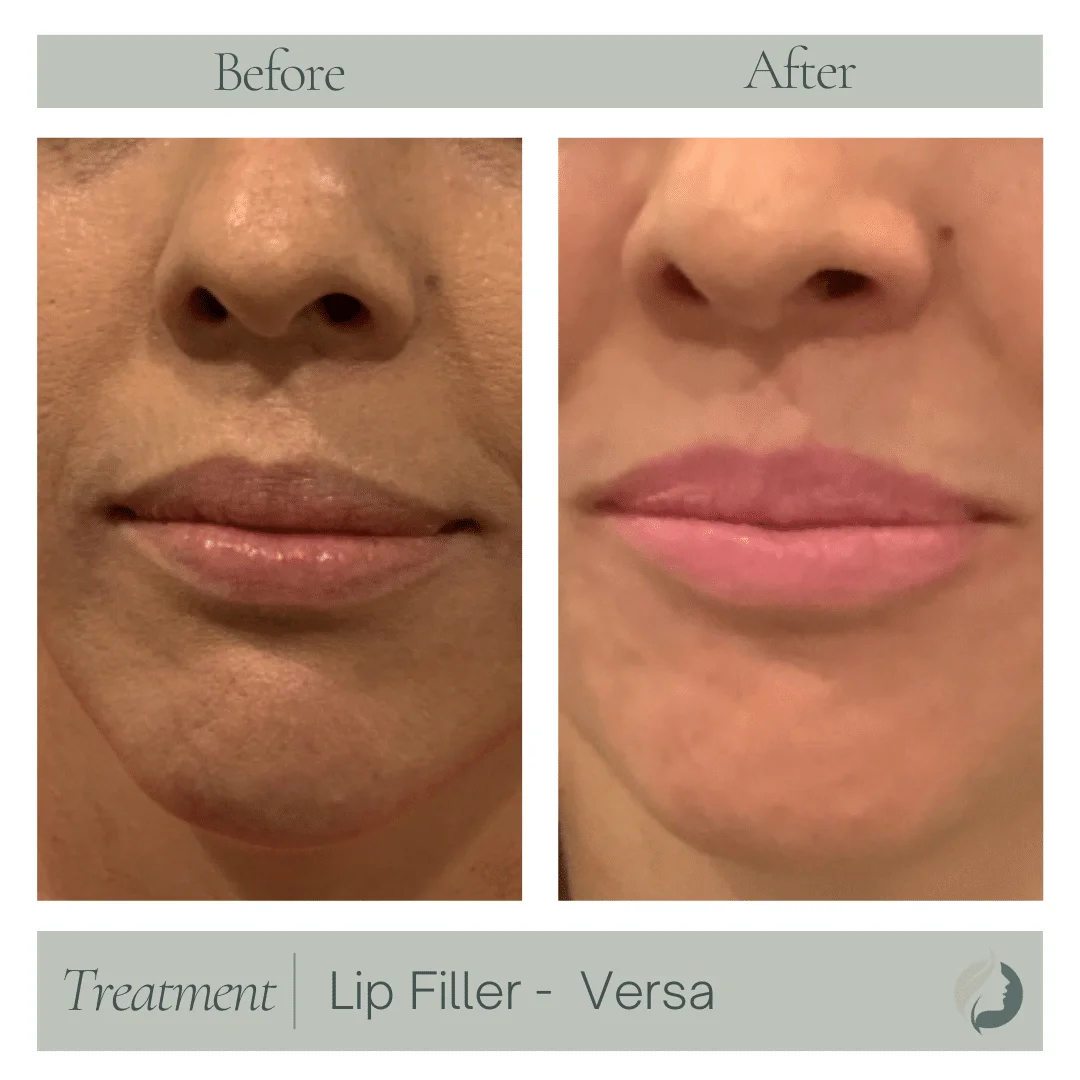 Premier Aesthetic Treatments in Burleson