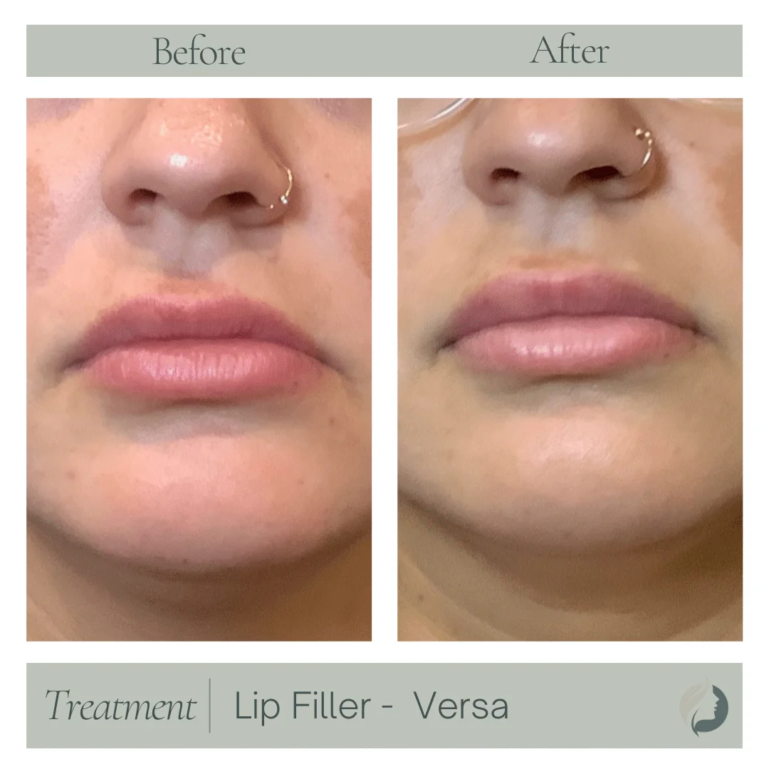 Premier Aesthetic Treatments in Burleson