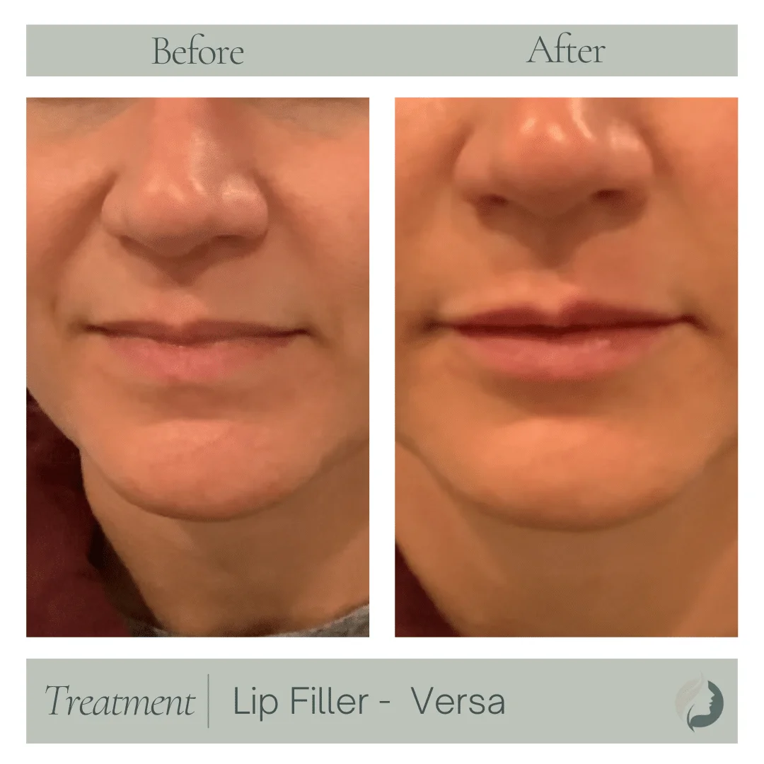 Premier Aesthetic Treatments in Burleson