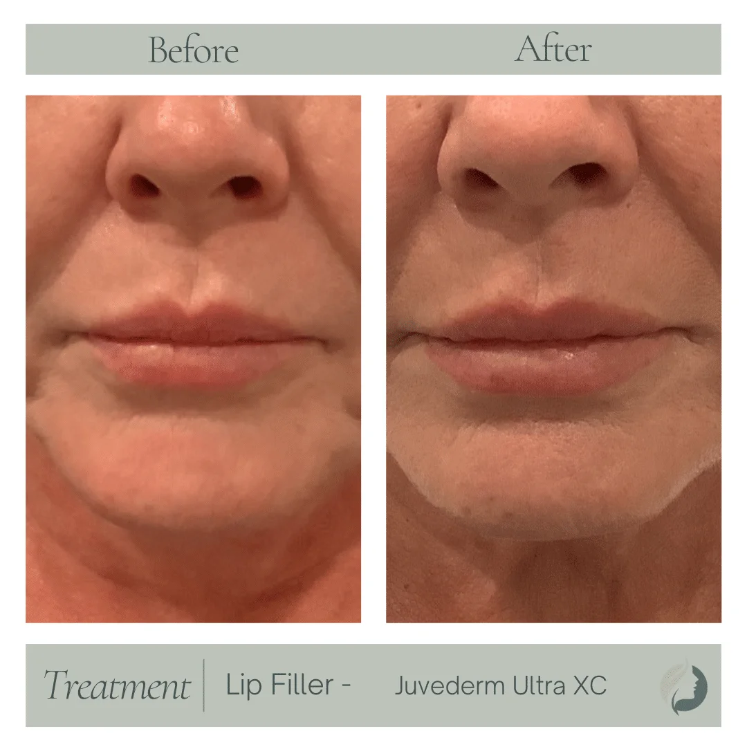 Premier Aesthetic Treatments in Burleson