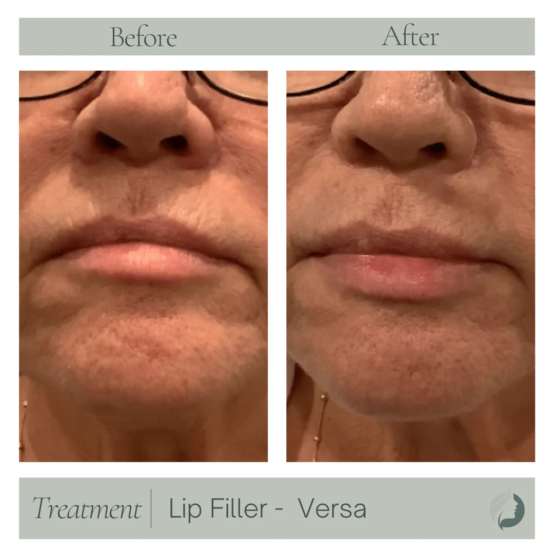 Premier Aesthetic Treatments in Burleson