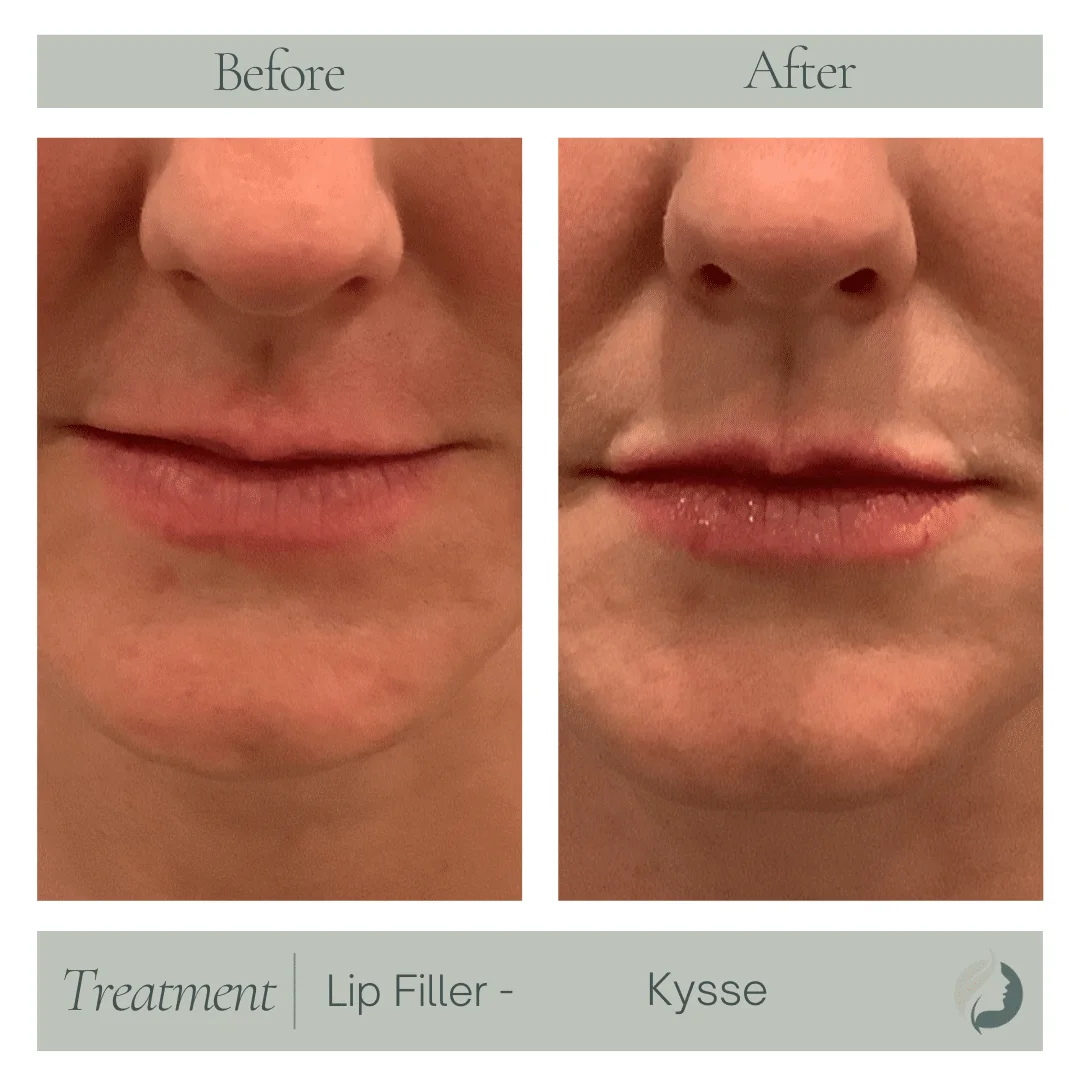 Premier Aesthetic Treatments in Burleson
