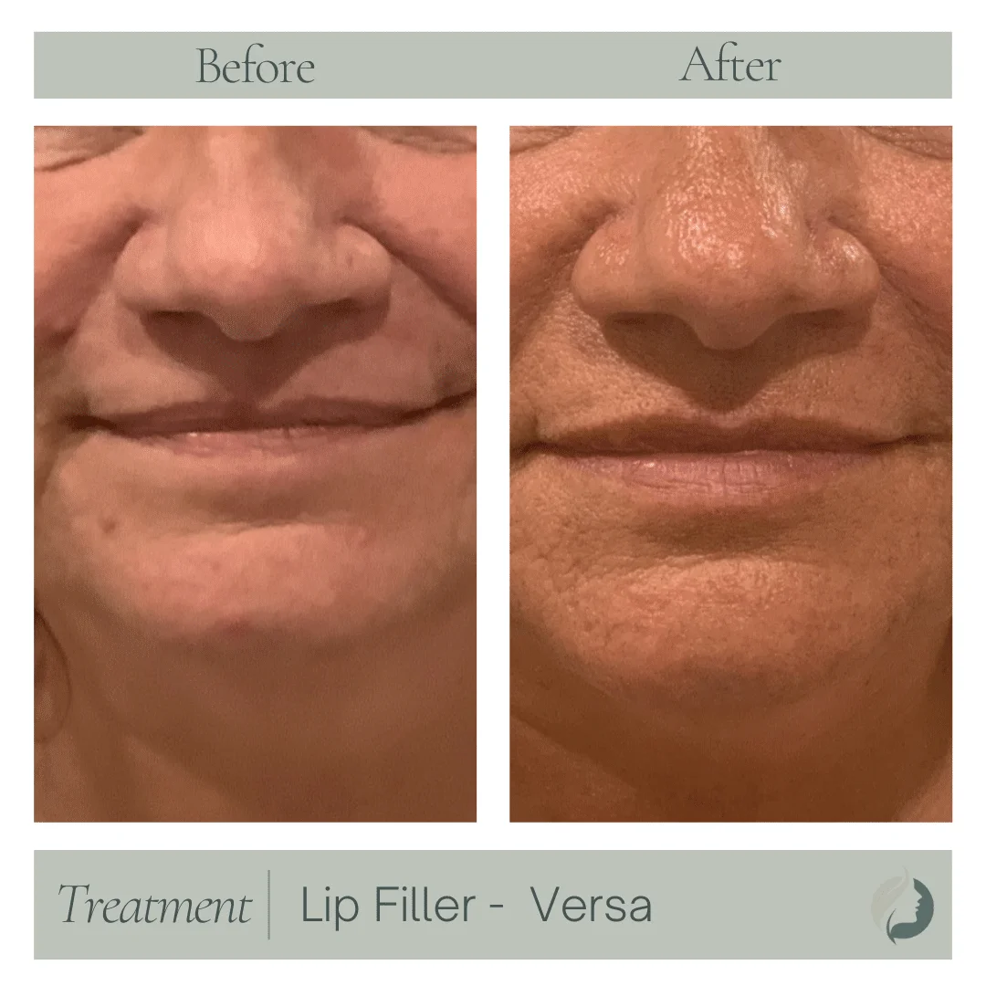 Premier Aesthetic Treatments in Burleson