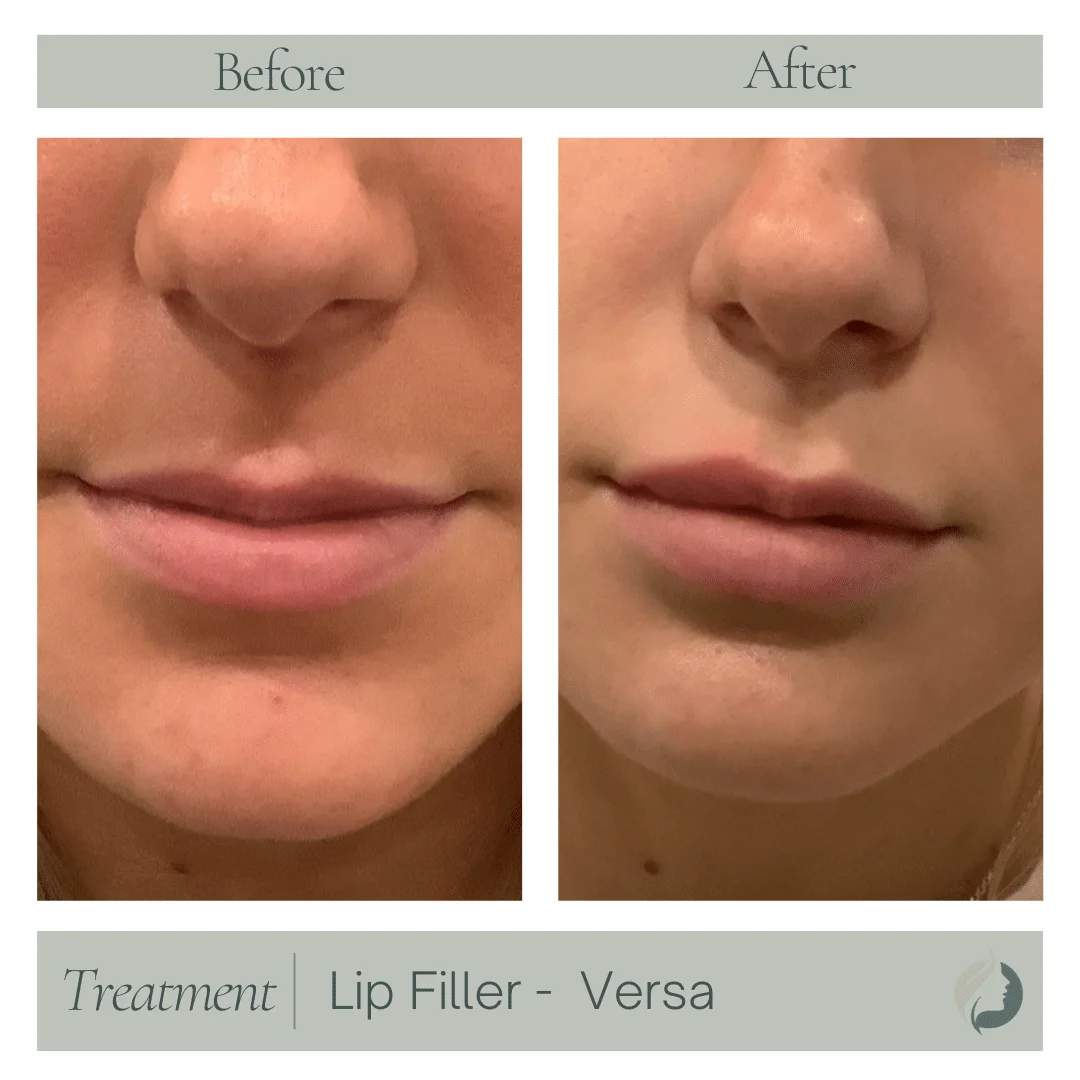 Premier Aesthetic Treatments in Burleson