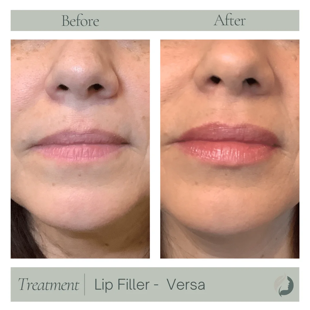 Premier Aesthetic Treatments in Burleson