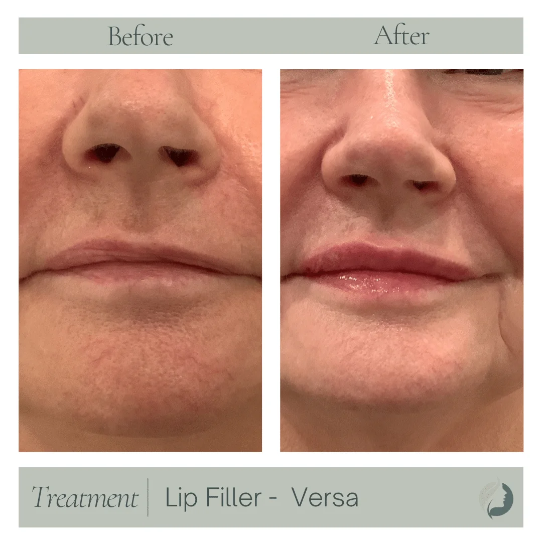 Premier Aesthetic Treatments in Burleson