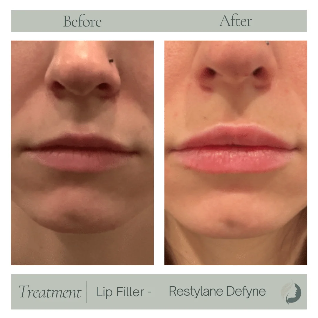 Premier Aesthetic Treatments in Burleson