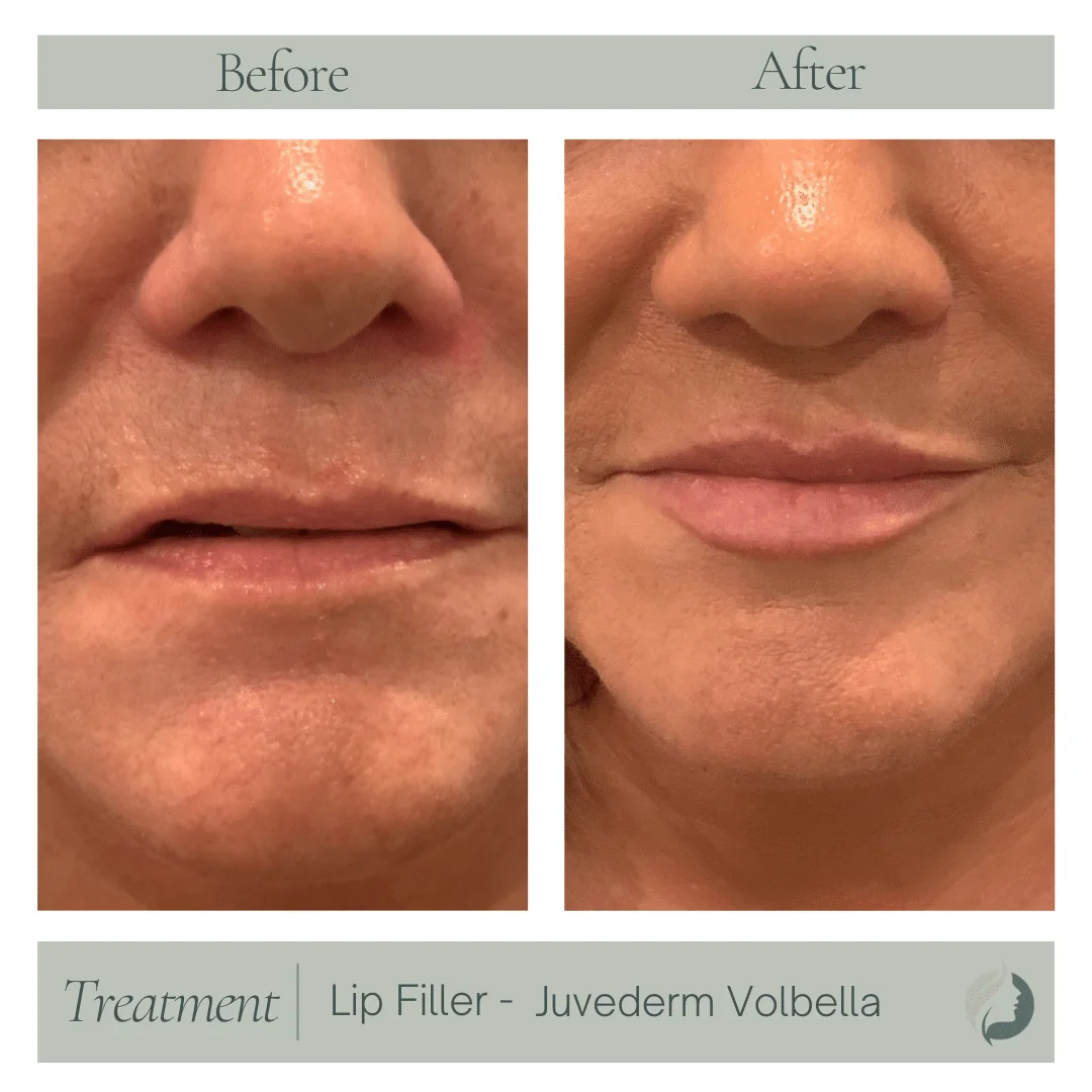 Premier Aesthetic Treatments in Burleson