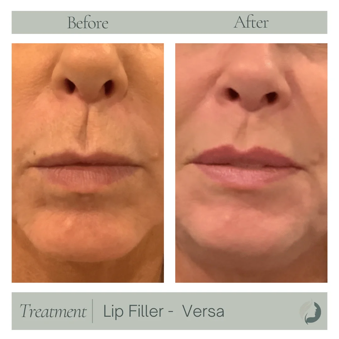 Premier Aesthetic Treatments in Burleson