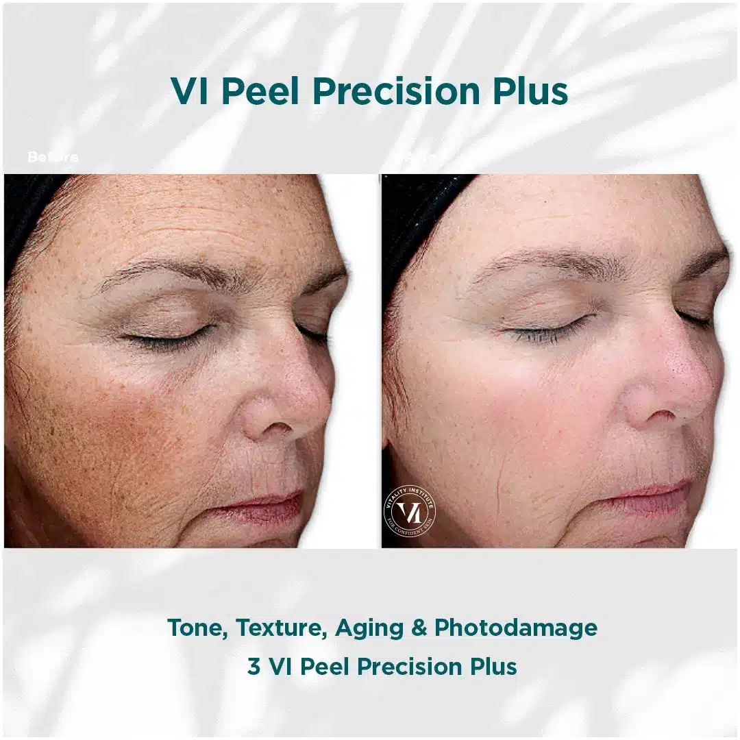 Premier Aesthetic Treatments in Burleson, TX