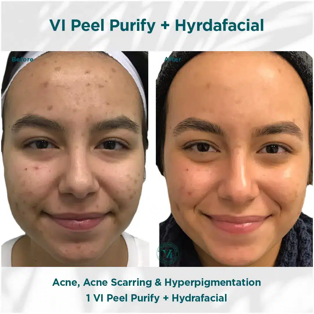 Premier Aesthetic Treatments in Burleson, TX