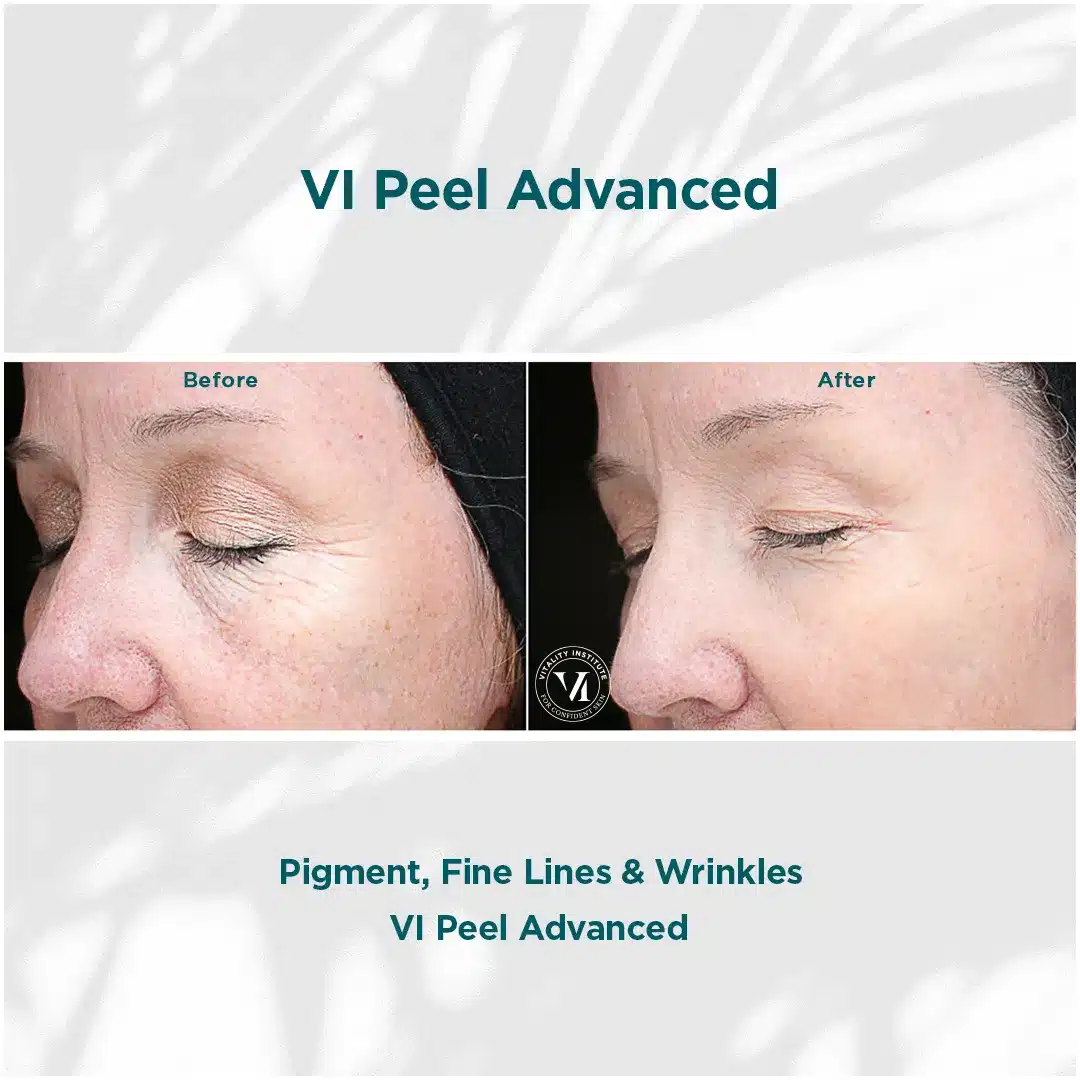 Premier Aesthetic Treatments in Burleson, TX