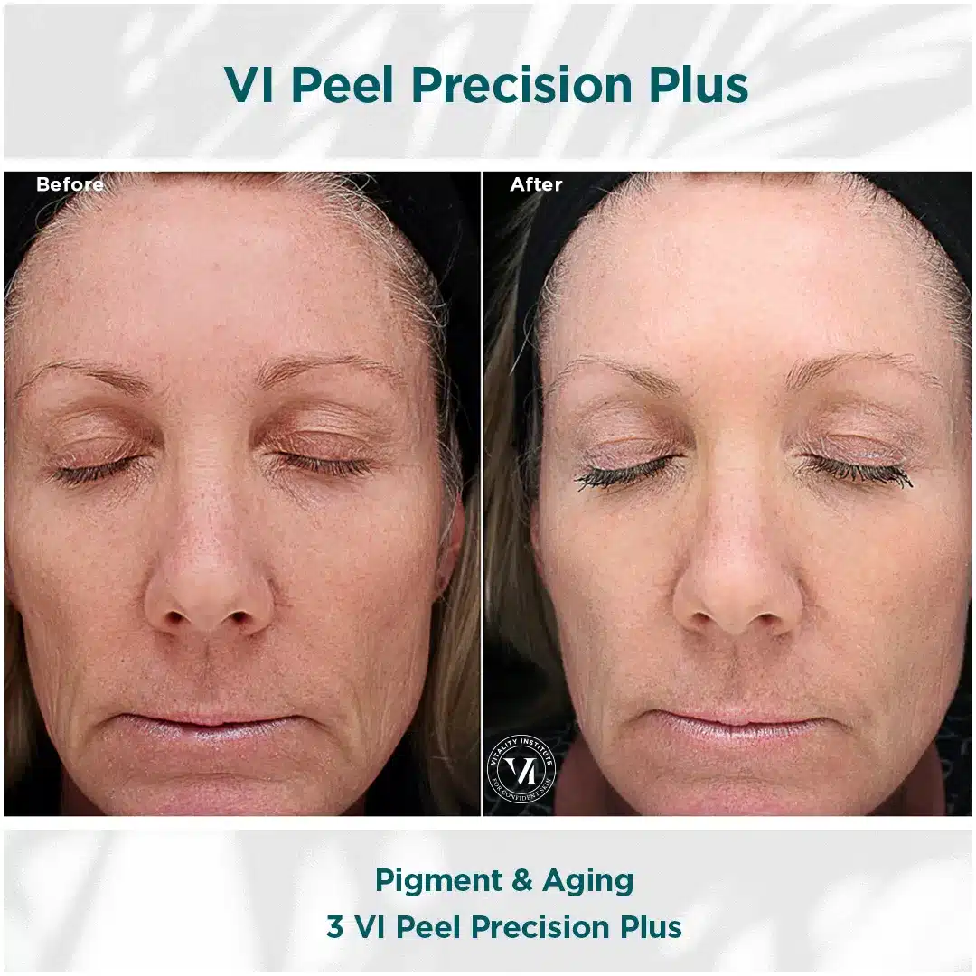 Premier Aesthetic Treatments in Burleson, TX