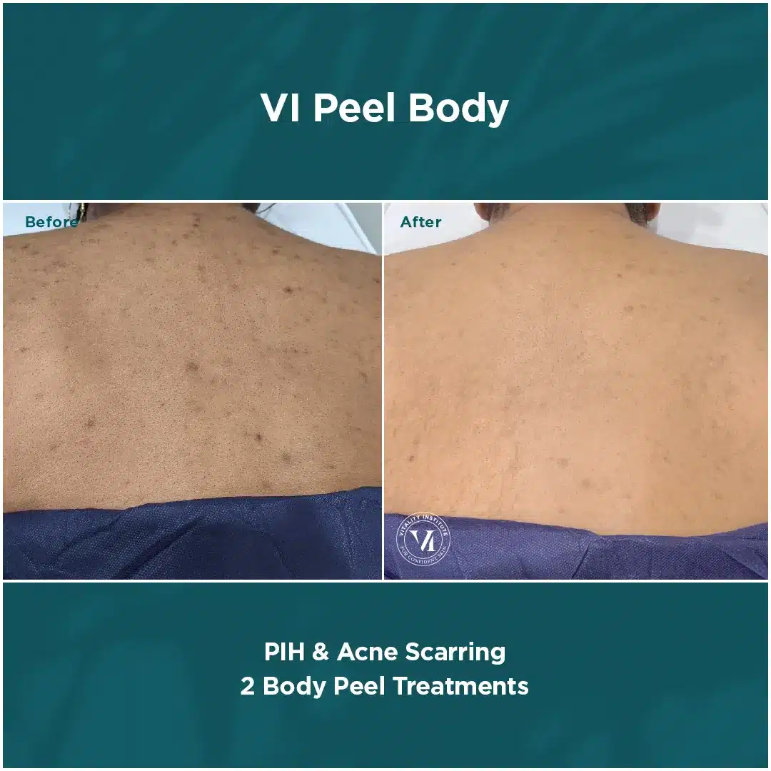 Premier Aesthetic Treatments in Burleson, TX