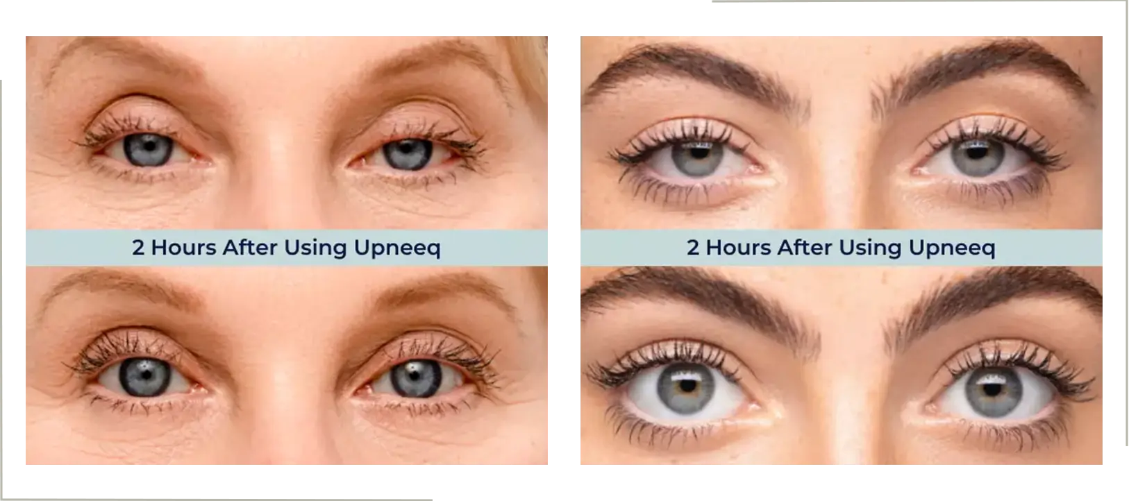 Before & After Upneeq