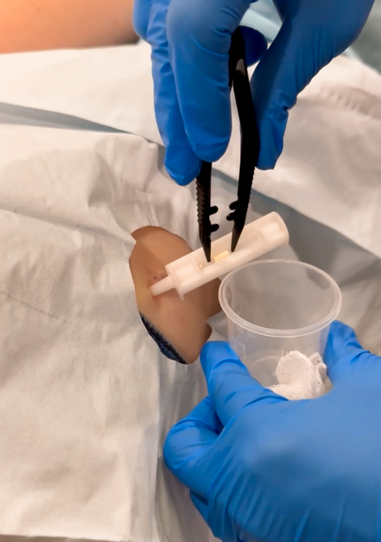 hormones hrt Premier Aesthetic Treatments in Burleson, TX