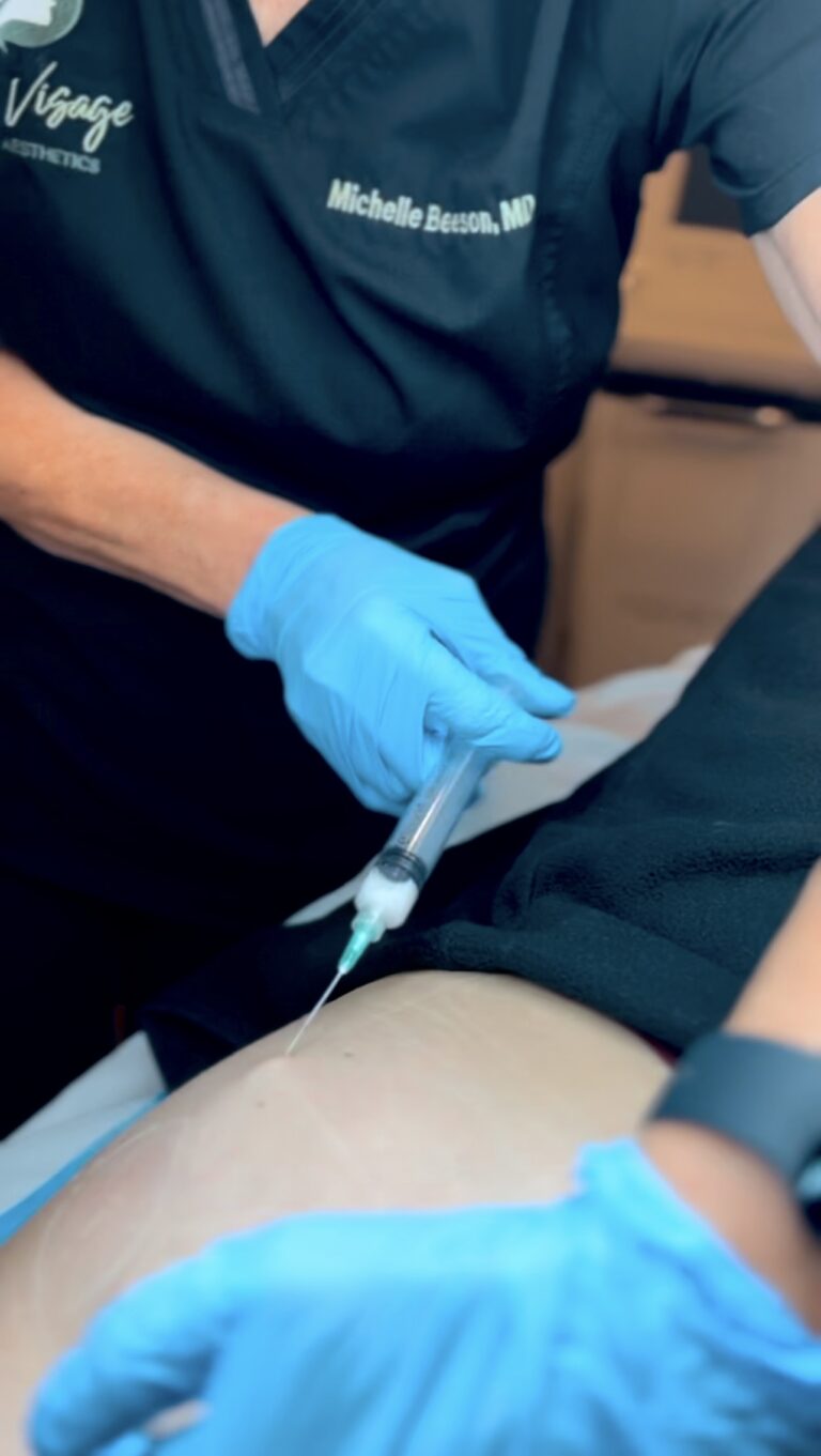 Liquid BBL Injectable Premier Aesthetic Treatment Burleson TX