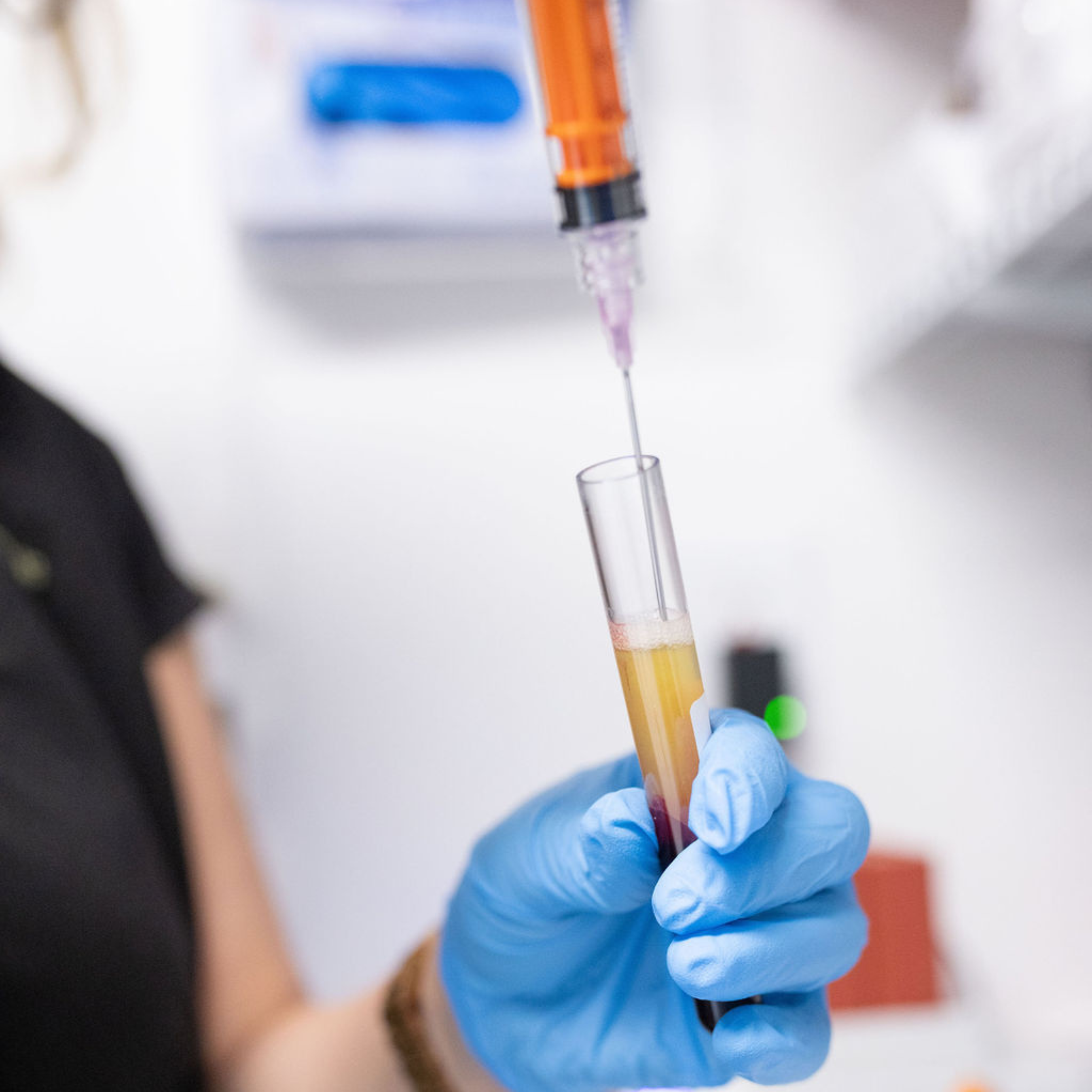 Bio Filler EZ Gel PRF PRP Treatment Premier Aesthetic Treatment Burleson TX