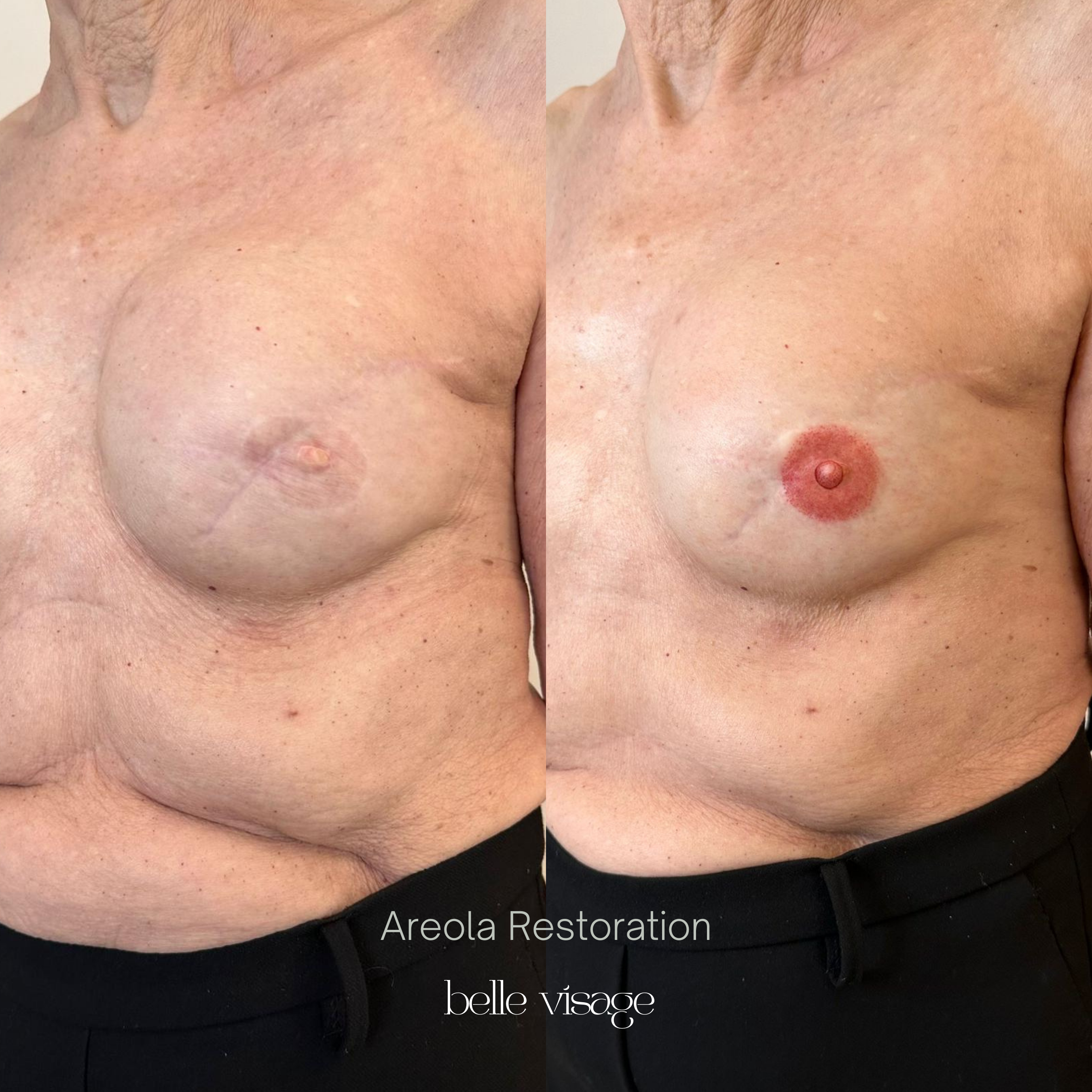 pmu permanent makeup areola correction burleson tx