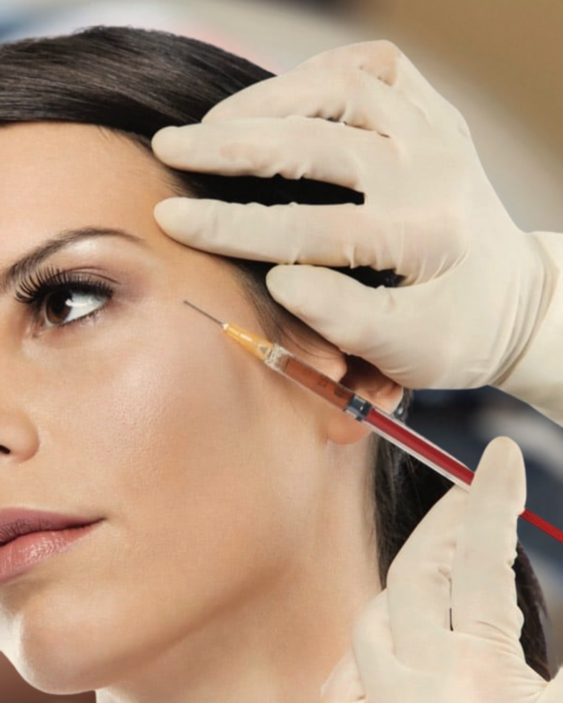 prf ez gel bio filler treatment burleson tx